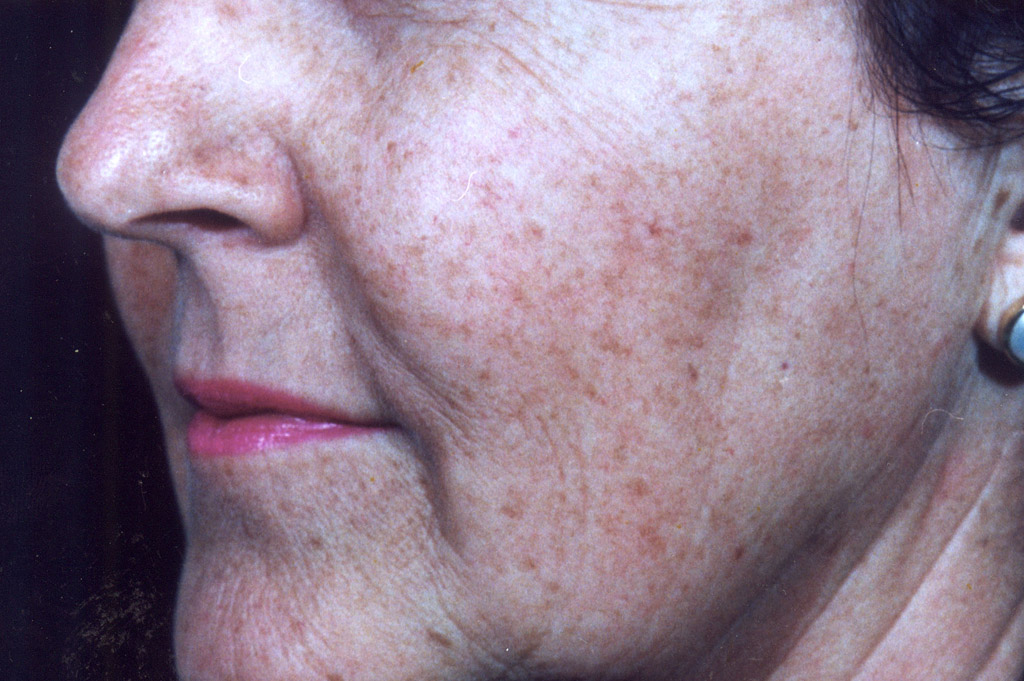 Environ Skin Care | What it can do for skin - Aging Skin - After
